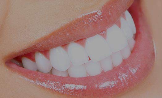 One of our most common cosmetic dentistry offers is teeth whitening.
