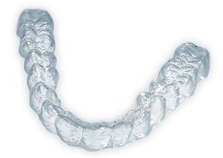 Invisalign clear aligners are an orthodontic treatment option to straighten your teeth discreetly