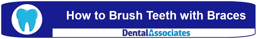How to Brush Teeth with Braces
