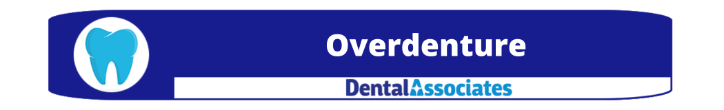 Overdenture